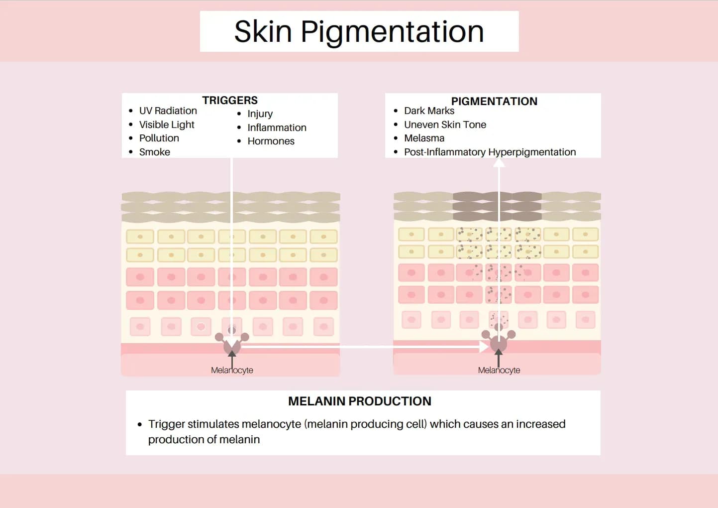Pigmentation: What It Is, The Problems, and How to Fix